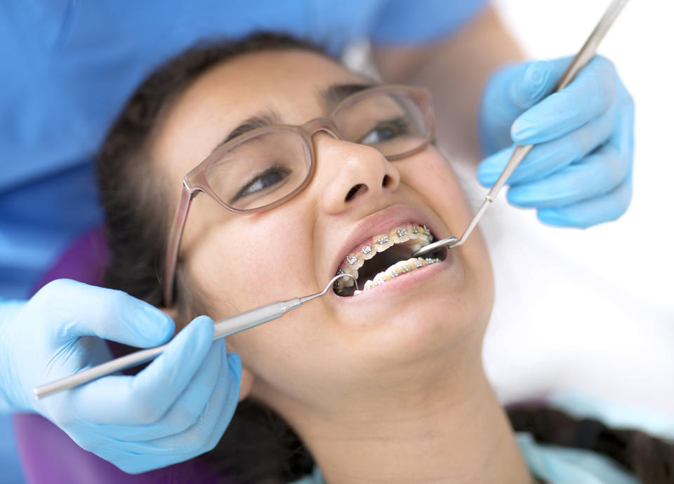 Can Dental Hygienists Do Braces?  