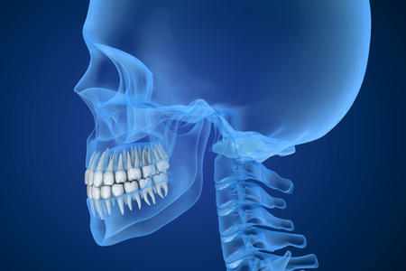 TMD representation on xray image of a human skull