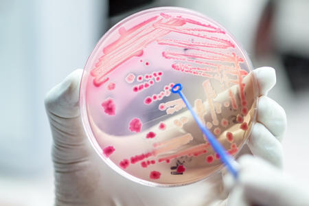 Microbe growth in a petri dish