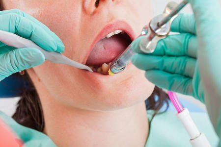 Local Anesthesia for Licensed Dental Assistants