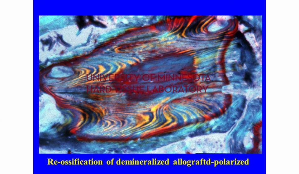 Re-ossification of demineralized allograftd-polarized