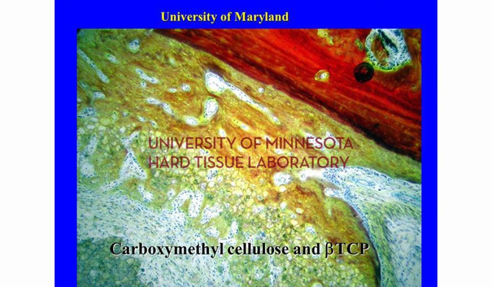 University of Maryland Carboxymethyl cellulose and BTCP