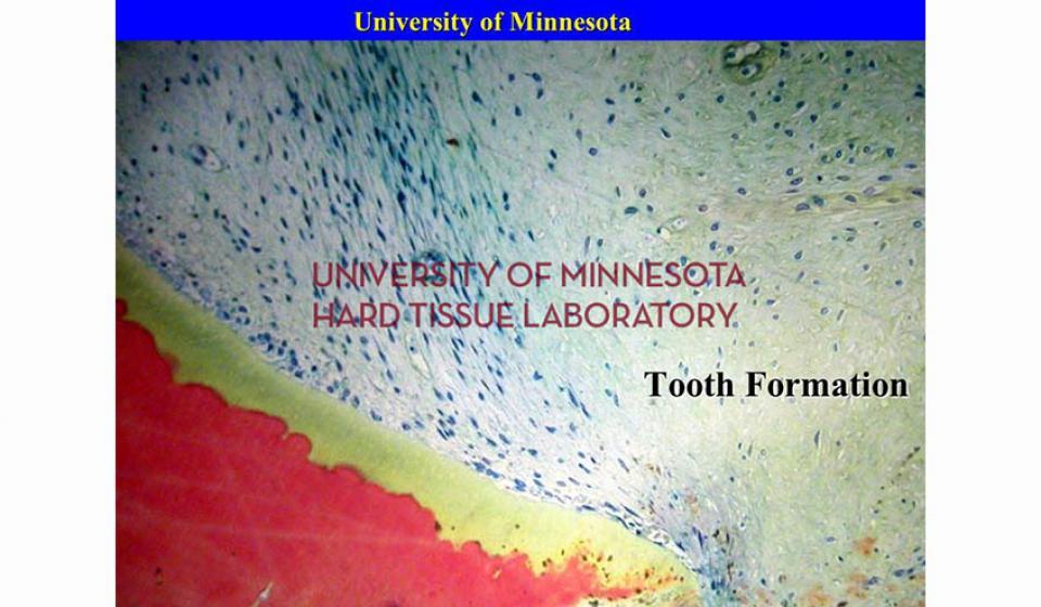 University of Minnesota Tooth Formation