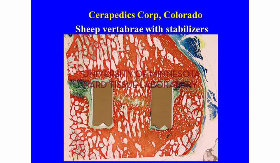 Cerapedics Corp, Colorado Sheep vertabrea with stabilizers