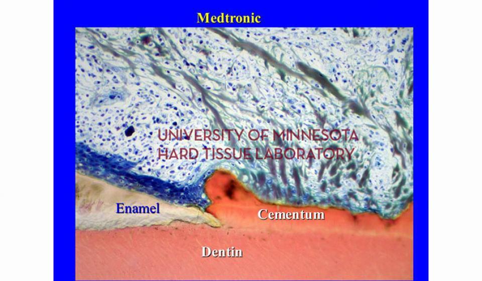 Medtronic Enamel Cementum Dentin