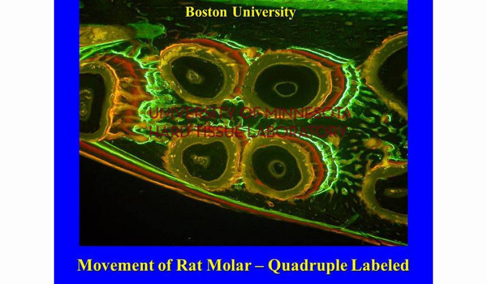 Boston University Movement of Rat Molar - Quadruple Labeled