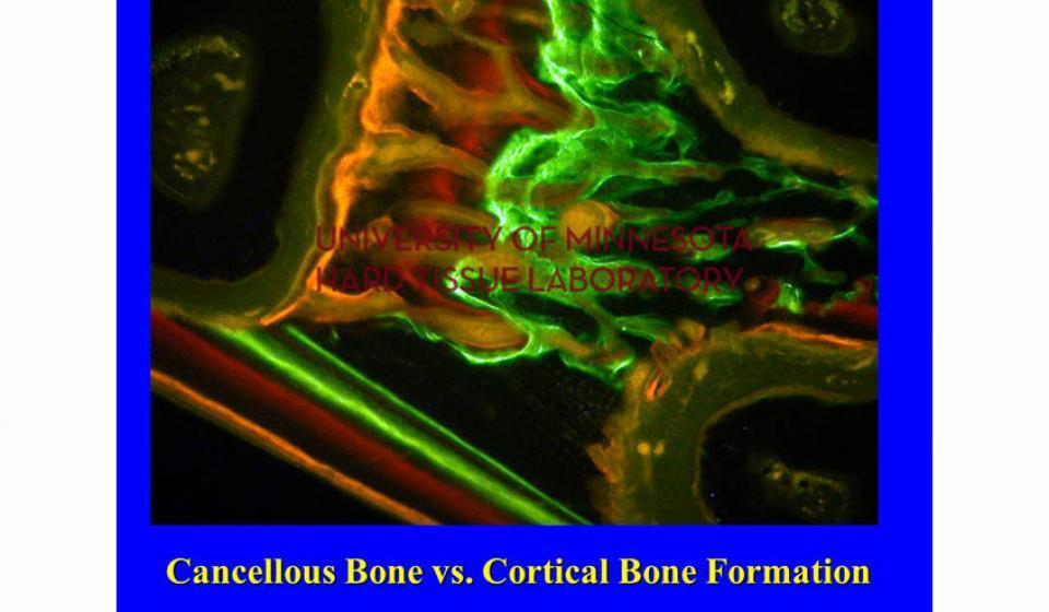 Cancellous Bone vs. Cortical Bone Formation