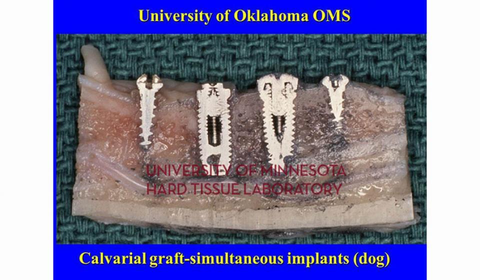University of Oklahoma OMS Calvarial graft-simultaneous implants (dog)
