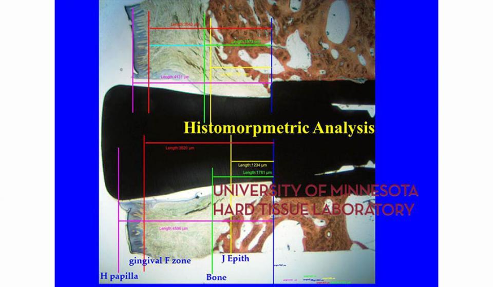 Histomorpmetric Analysis