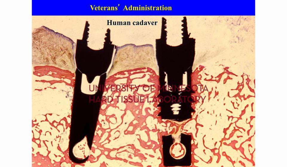 Veterans' Administration Human cadaver