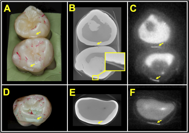 Dental MRI images