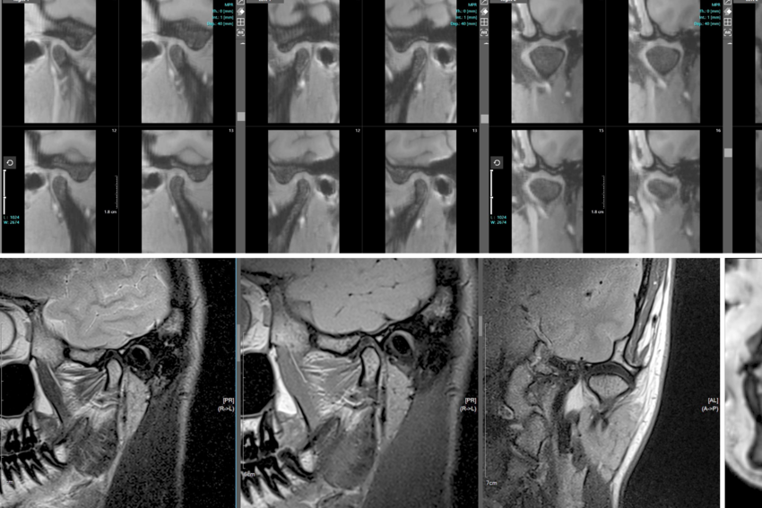 OMRIC MRI scan images collage